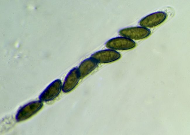 The eight spores within the ascus within the perithecia within the stromata of Beech Woodwart (Hypoxylon fragiforme)