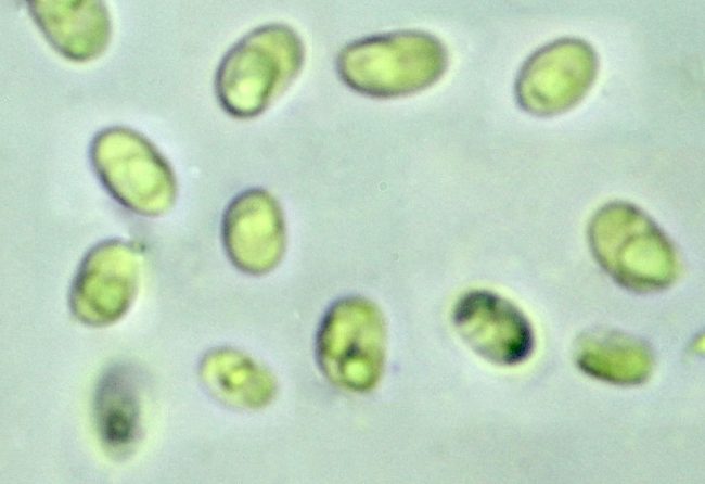 The spores of Schizopora paradoxa, with visible oil drops inside them