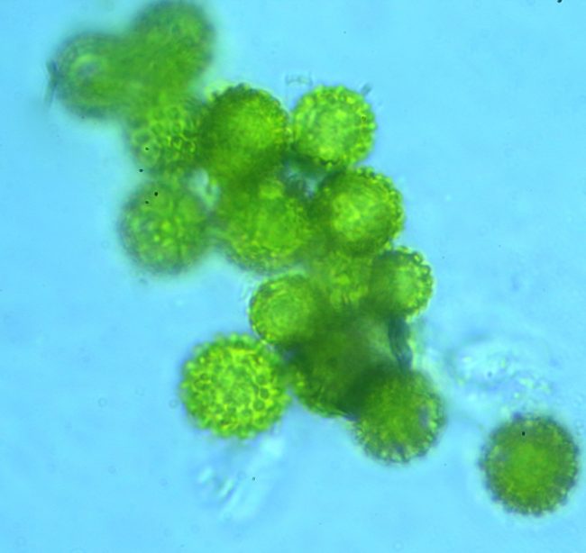 The warted yellow asexual spores of Hypomyces chrysospermus in its second phase