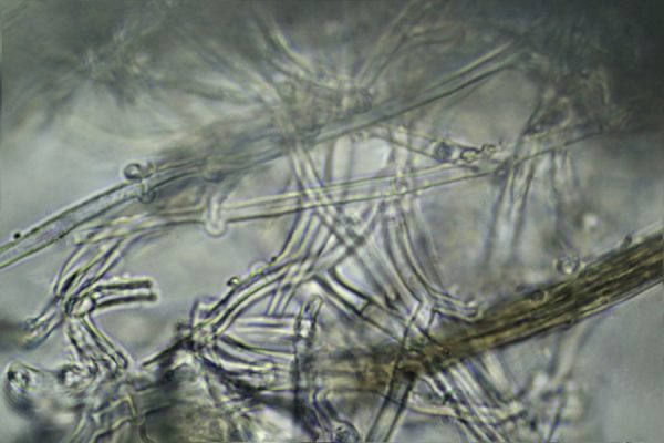  The mycelium of the Elder Whitewash under the microscope, x1000 magnification. 